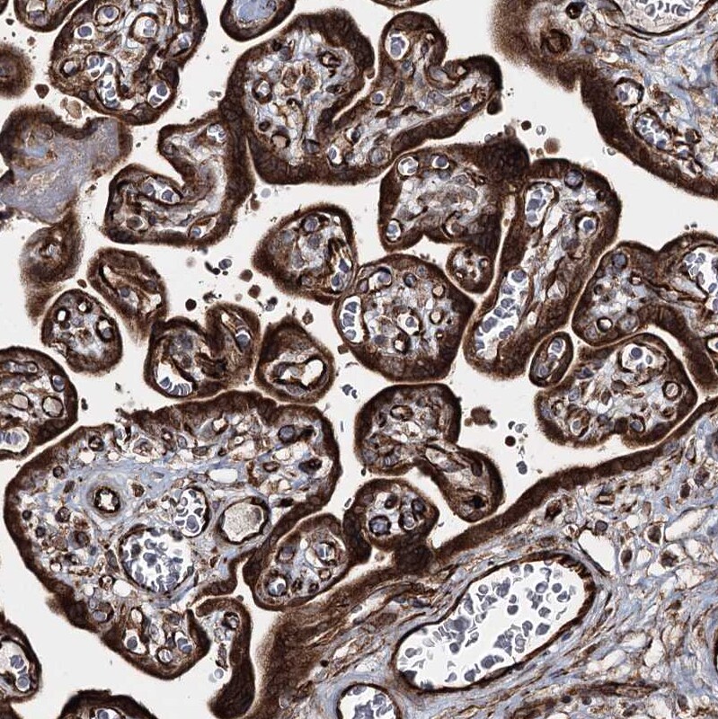 HECTD2 Antibody - BSA Free Immunohistochemistry-Paraffin: HECTD2 Antibody [NBP1-83481]
