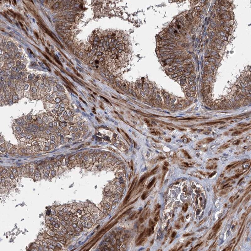 HECTD2 Antibody - BSA Free Immunohistochemistry-Paraffin: HECTD2 Antibody [NBP1-83481]