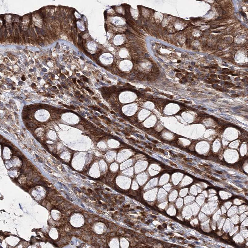 HECTD2 Antibody - BSA Free Immunohistochemistry-Paraffin: HECTD2 Antibody [NBP1-83481]