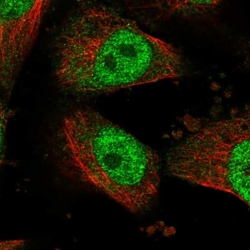 HECTD2 Antibody - BSA Free Immunocytochemistry/ Immunofluorescence: HECTD2 Antibody - BSA Free [NBP1-83481]