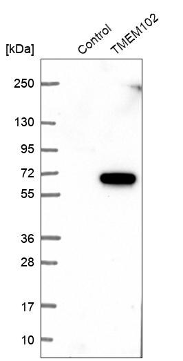 TMEM102 Antibody - BSA Free Western Blot: TMEM102 Antibody - BSA Free [NBP1-83484]