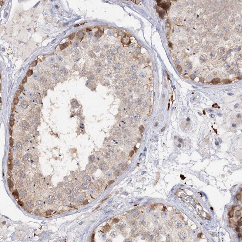 PIWIL4 Antibody - BSA Free Immunohistochemistry-Paraffin: PIWIL4 Antibody [NBP1-83491]