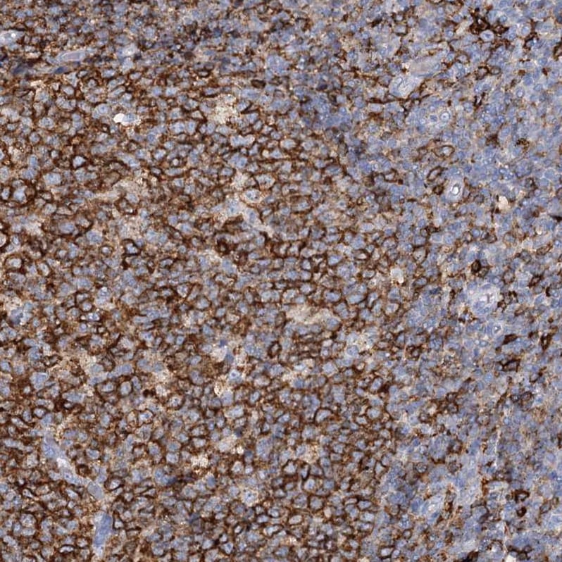 PIWIL4 Antibody - BSA Free Immunohistochemistry-Paraffin: PIWIL4 Antibody [NBP1-83491]