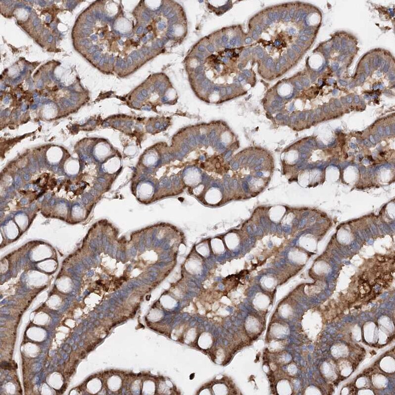 PIWIL4 Antibody - BSA Free Immunohistochemistry-Paraffin: PIWIL4 Antibody - BSA Free [NBP1-83491]