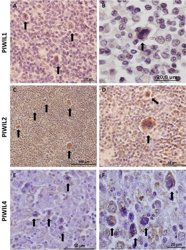 PIWIL4 Antibody