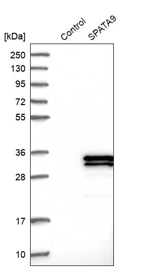 SPATA9 Antibody - BSA Free Western Blot: SPATA9 Antibody - BSA Free [NBP1-83493]