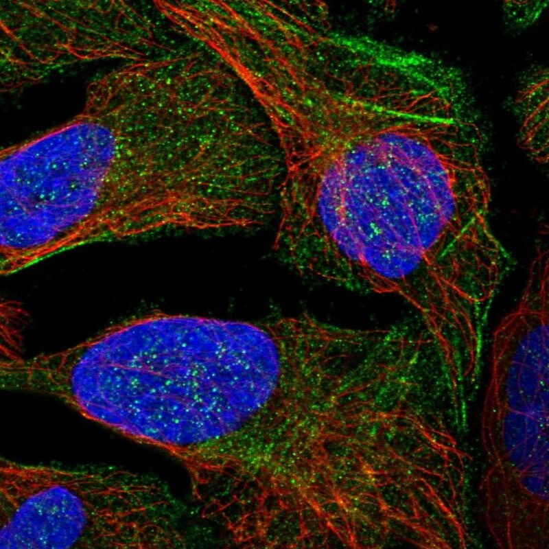 LYSMD4 Antibody - BSA Free Immunocytochemistry/ Immunofluorescence: LYSMD4 Antibody [NBP1-83511]