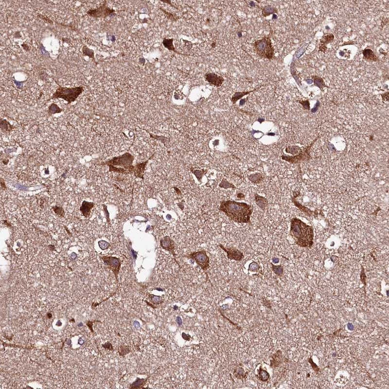 HYLS1 Antibody - BSA Free Immunohistochemistry-Paraffin: HYLS1 Antibody [NBP1-83513]