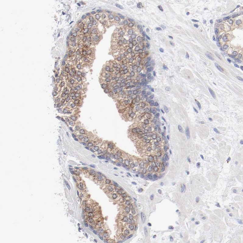 AK7 Antibody - BSA Free Immunohistochemistry-Paraffin: AK7 Antibody - BSA Free [NBP1-83515]