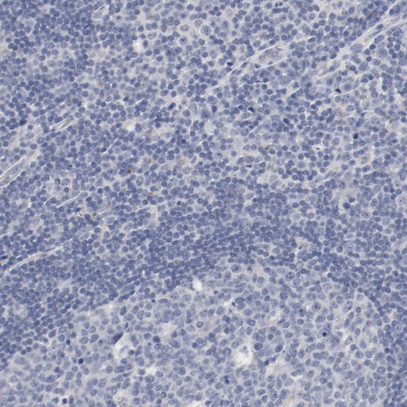 AK7 Antibody - BSA Free Immunohistochemistry-Paraffin: AK7 Antibody - BSA Free [NBP1-83515]