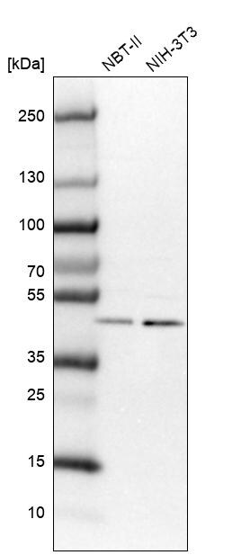 VPS37A Antibody - BSA Free Western Blot: VPS37A Antibody - BSA Free [NBP1-83528]