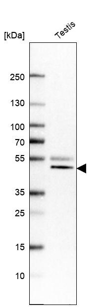 VPS37A Antibody - BSA Free Western Blot: VPS37A Antibody - BSA Free [NBP1-83528]