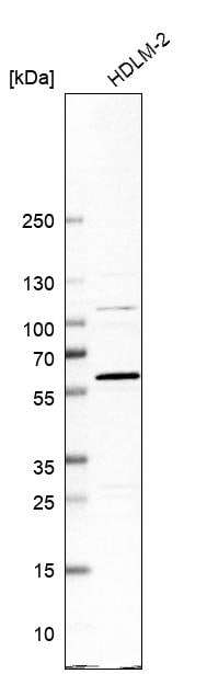 ADHFE1 Antibody - BSA Free Western Blot: ADHFE1 Antibody - BSA Free [NBP1-83530]