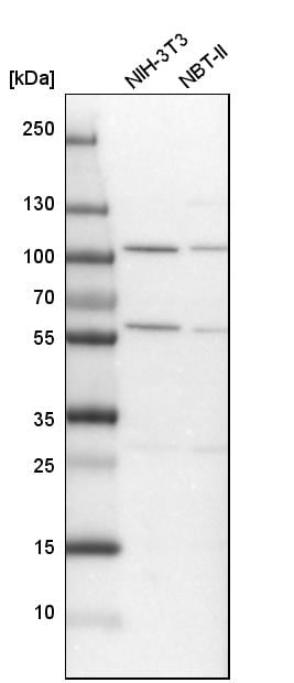 ADHFE1 Antibody - BSA Free Western Blot: ADHFE1 Antibody - BSA Free [NBP1-83530]