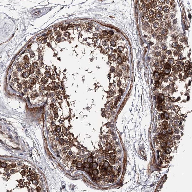CWF19L2 Antibody - BSA Free Immunohistochemistry-Paraffin: CWF19L2 Antibody [NBP1-83533]