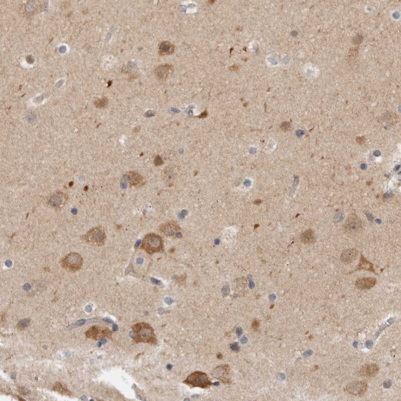 CCDC43 Antibody - BSA Free Immunohistochemistry-Paraffin: CCDC43 Antibody - BSA Free [NBP1-83536]