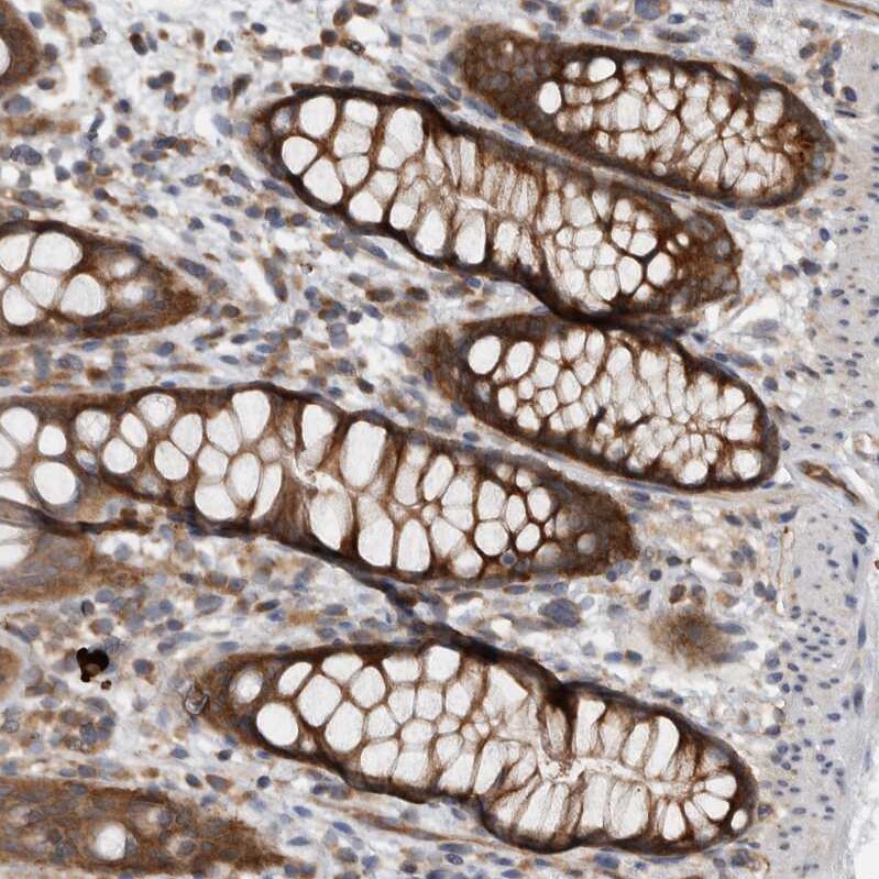 CCDC43 Antibody - BSA Free Immunohistochemistry-Paraffin: CCDC43 Antibody - BSA Free [NBP1-83536]