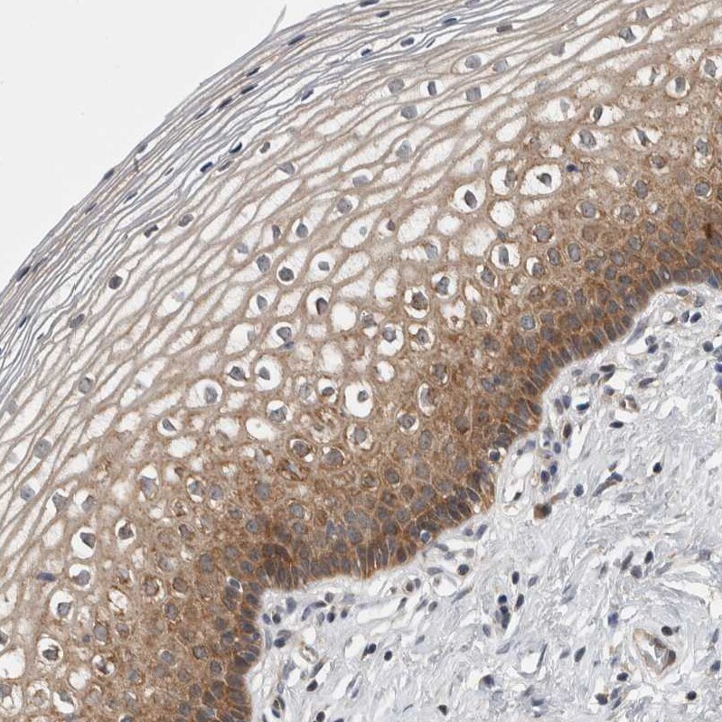 CCDC43 Antibody - BSA Free Immunohistochemistry-Paraffin: CCDC43 Antibody - BSA Free [NBP1-83536]