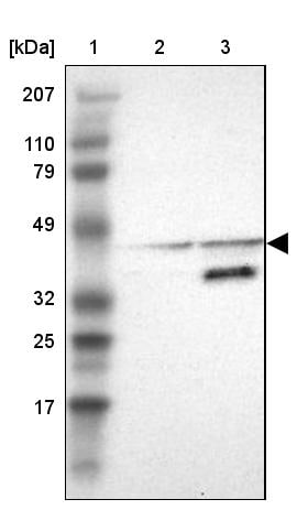 ACOT4 Antibody - BSA Free Western Blot: ACOT4 Antibody - BSA Free [NBP1-83539]