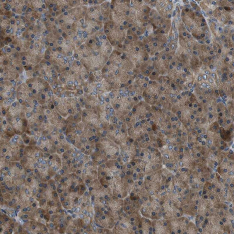 TMEM74 Antibody - BSA Free Immunohistochemistry-Paraffin: TMEM74 Antibody [NBP1-83546]