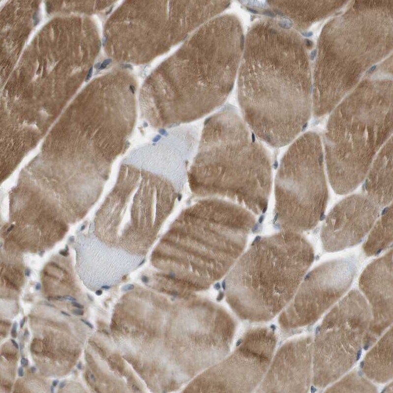 TMEM74 Antibody - BSA Free Immunohistochemistry-Paraffin: TMEM74 Antibody [NBP1-83546]