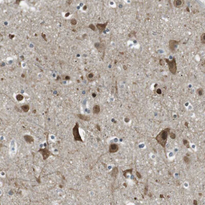 TMEM74 Antibody - BSA Free Immunohistochemistry-Paraffin: TMEM74 Antibody [NBP1-83546]