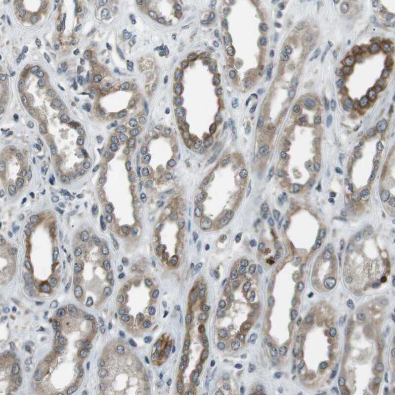 TMEM74 Antibody - BSA Free Immunohistochemistry-Paraffin: TMEM74 Antibody [NBP1-83546]