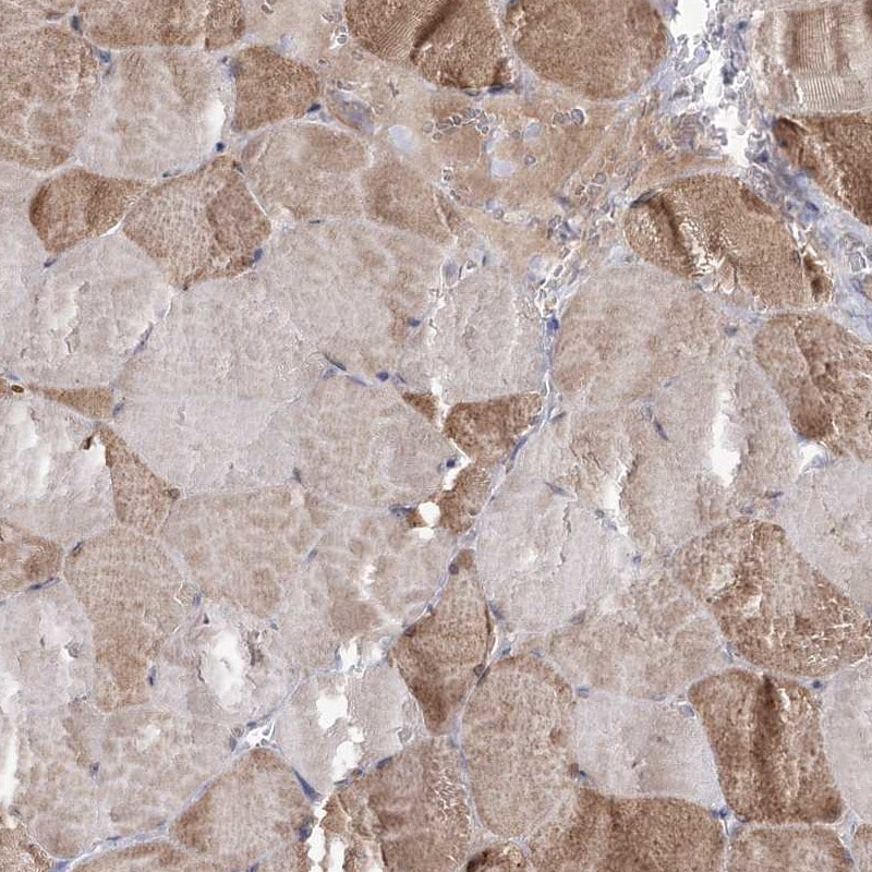 NADKD1 Antibody - BSA Free Immunohistochemistry-Paraffin: NADKD1 Antibody [NBP1-83547]