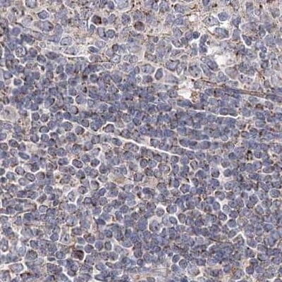 NADKD1 Antibody - BSA Free Immunohistochemistry-Paraffin: NADKD1 Antibody [NBP1-83547]