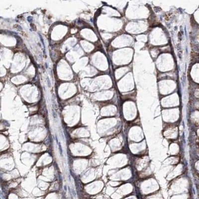 NADKD1 Antibody - BSA Free Immunohistochemistry-Paraffin: NADKD1 Antibody [NBP1-83547]