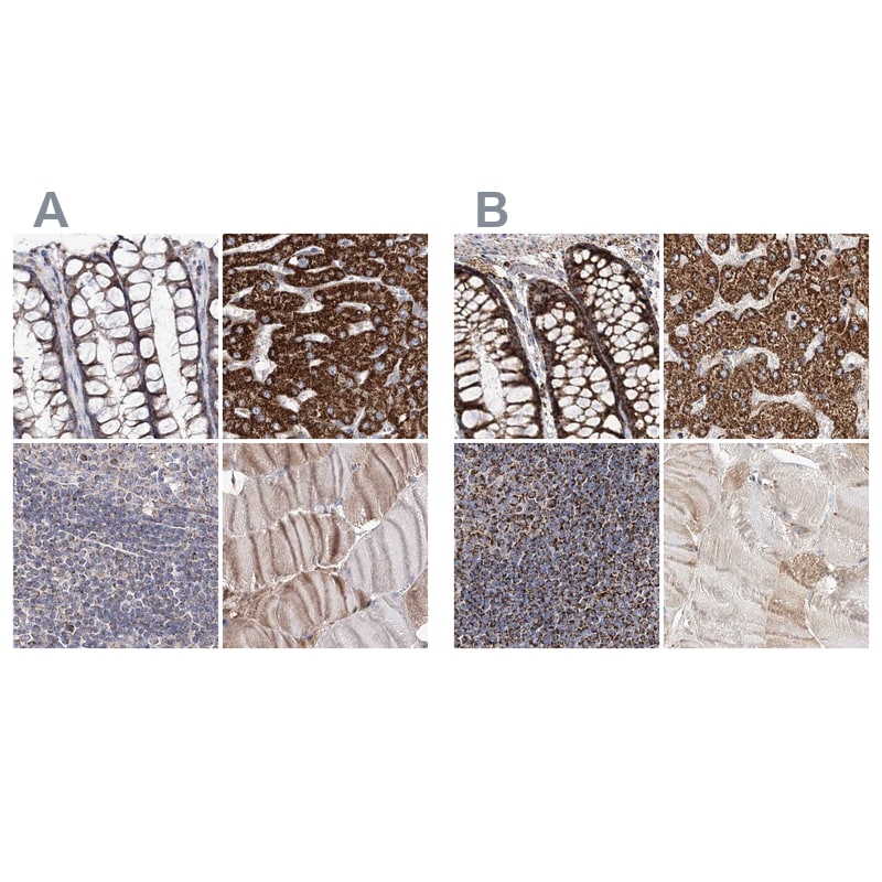 NADKD1 Antibody - BSA Free Immunohistochemistry-Paraffin: NADKD1 Antibody [NBP1-83547]