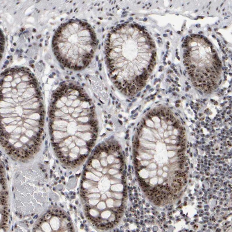 Surf6 Antibody - BSA Free Immunohistochemistry-Paraffin: Surf6 Antibody - BSA Free [NBP1-83550]