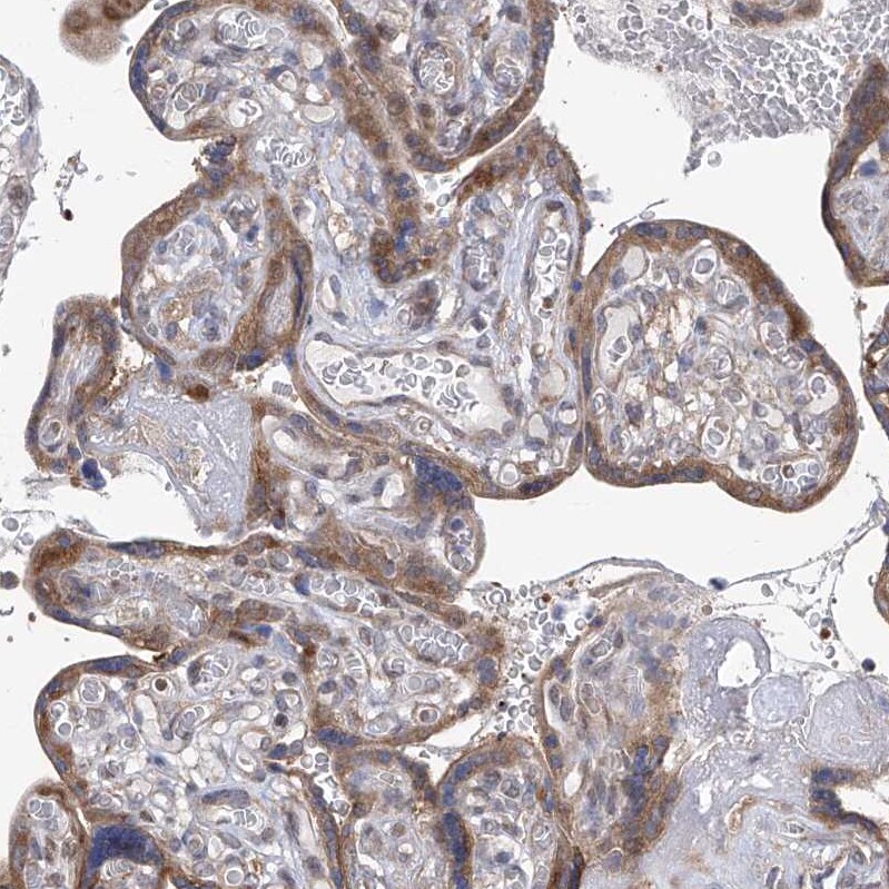 EIF3M Antibody - BSA Free Immunohistochemistry-Paraffin: EIF3M Antibody - BSA Free [NBP1-83552]