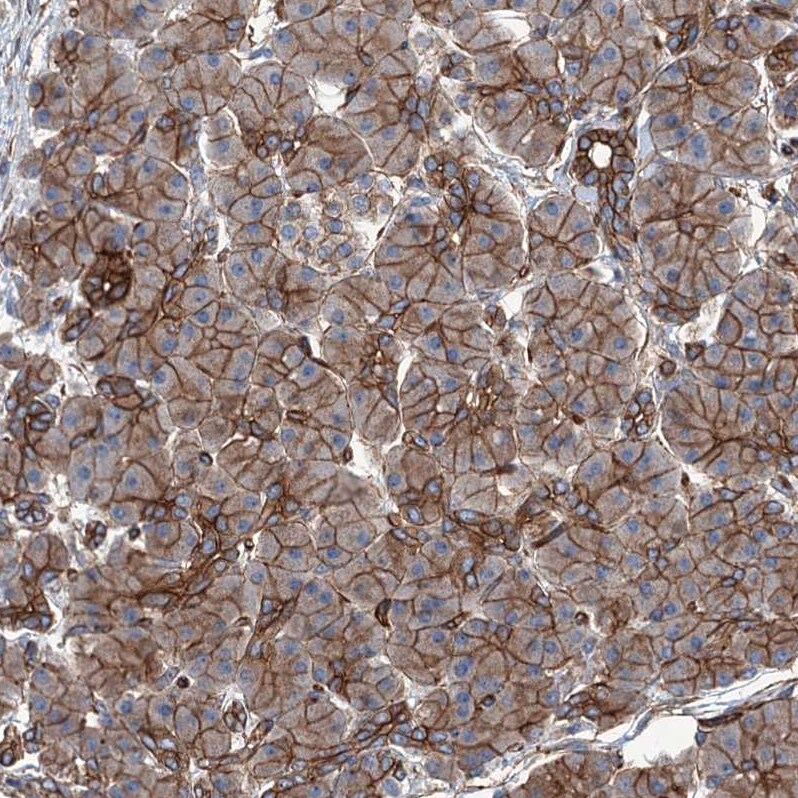 NMRAL1 Antibody - BSA Free Immunohistochemistry-Paraffin: NMRAL1 Antibody - BSA Free [NBP1-83554]