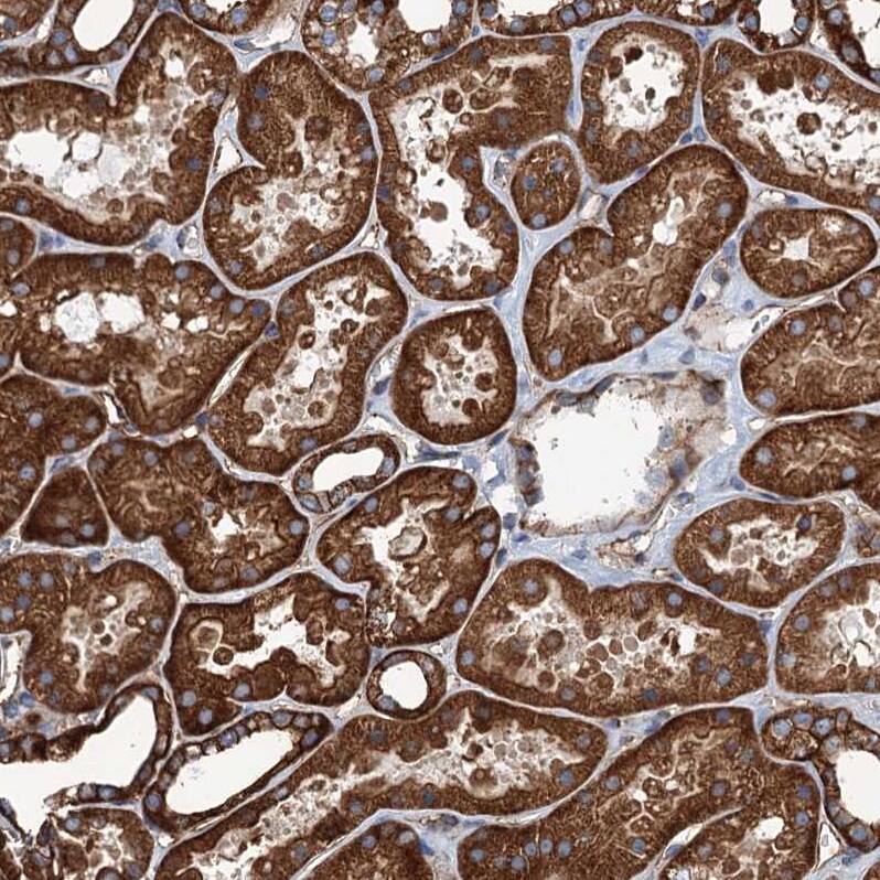 NMRAL1 Antibody - BSA Free Immunohistochemistry-Paraffin: NMRAL1 Antibody - BSA Free [NBP1-83554]