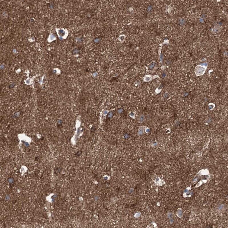 NMRAL1 Antibody - BSA Free Immunohistochemistry-Paraffin: NMRAL1 Antibody - BSA Free [NBP1-83554]