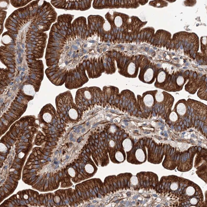 NMRAL1 Antibody - BSA Free Immunohistochemistry-Paraffin: NMRAL1 Antibody - BSA Free [NBP1-83554]