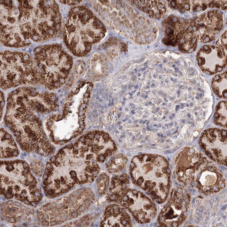 GRPEL1 Antibody - BSA Free Immunohistochemistry-Paraffin: GRPEL1 Antibody - BSA Free [NBP1-83557]