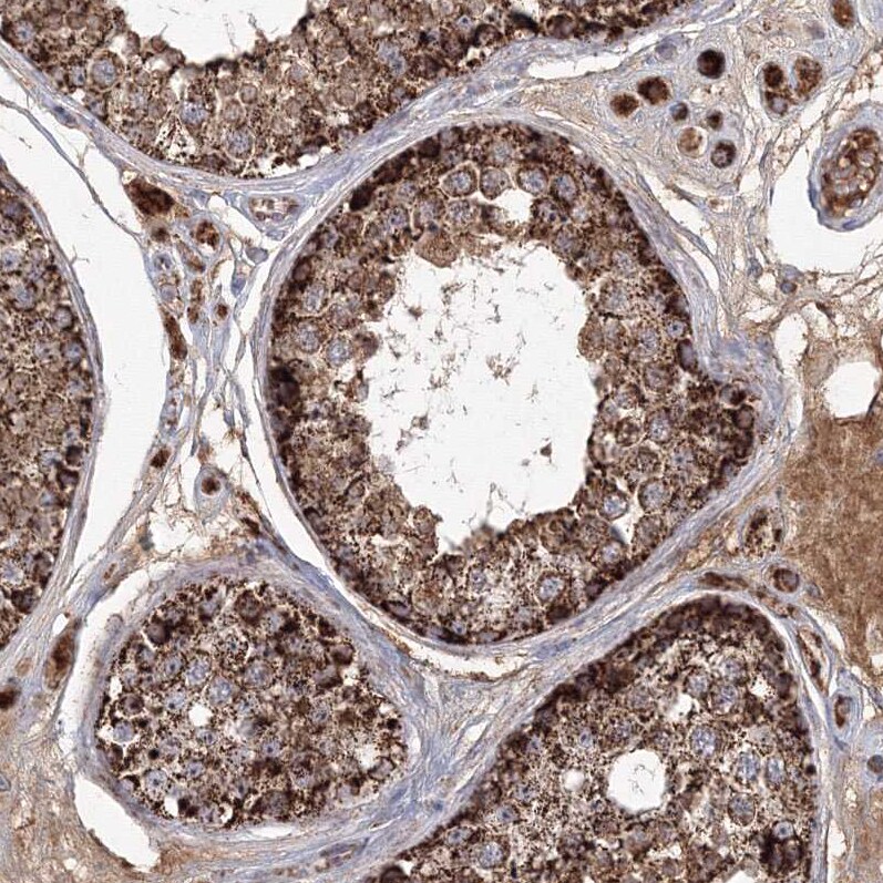 GRPEL1 Antibody - BSA Free Immunohistochemistry-Paraffin: GRPEL1 Antibody - BSA Free [NBP1-83557]