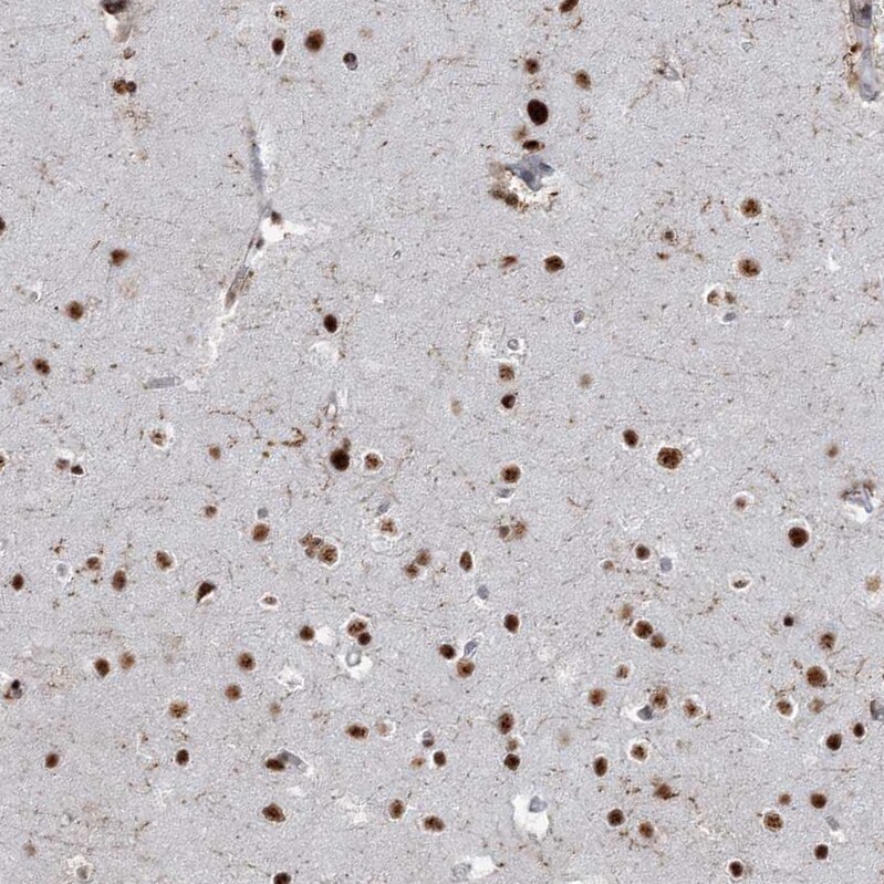 DDX46 Antibody - BSA Free Immunohistochemistry-Paraffin: DDX46 Antibody - BSA Free [NBP1-83565]