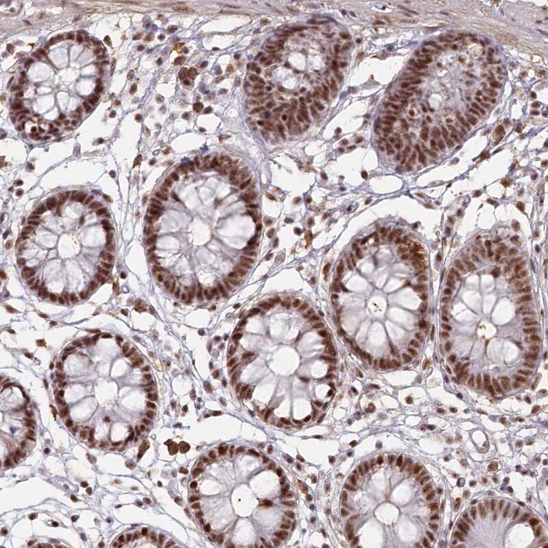 DDX46 Antibody - BSA Free Immunohistochemistry-Paraffin: DDX46 Antibody - BSA Free [NBP1-83565]