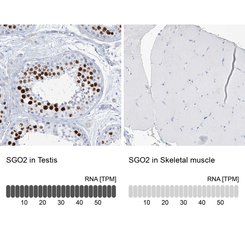 SGOL2 Antibody - BSA Free Immunohistochemistry-Paraffin: SGOL2 Antibody [NBP1-83567]