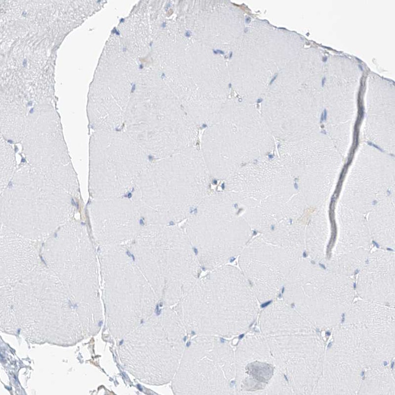 SGOL2 Antibody - BSA Free Immunohistochemistry-Paraffin: SGOL2 Antibody [NBP1-83567]