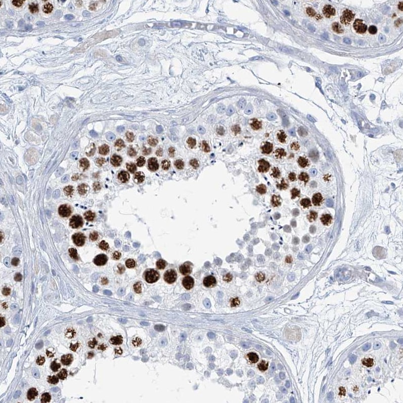 SGOL2 Antibody - BSA Free Immunohistochemistry-Paraffin: SGOL2 Antibody [NBP1-83567]