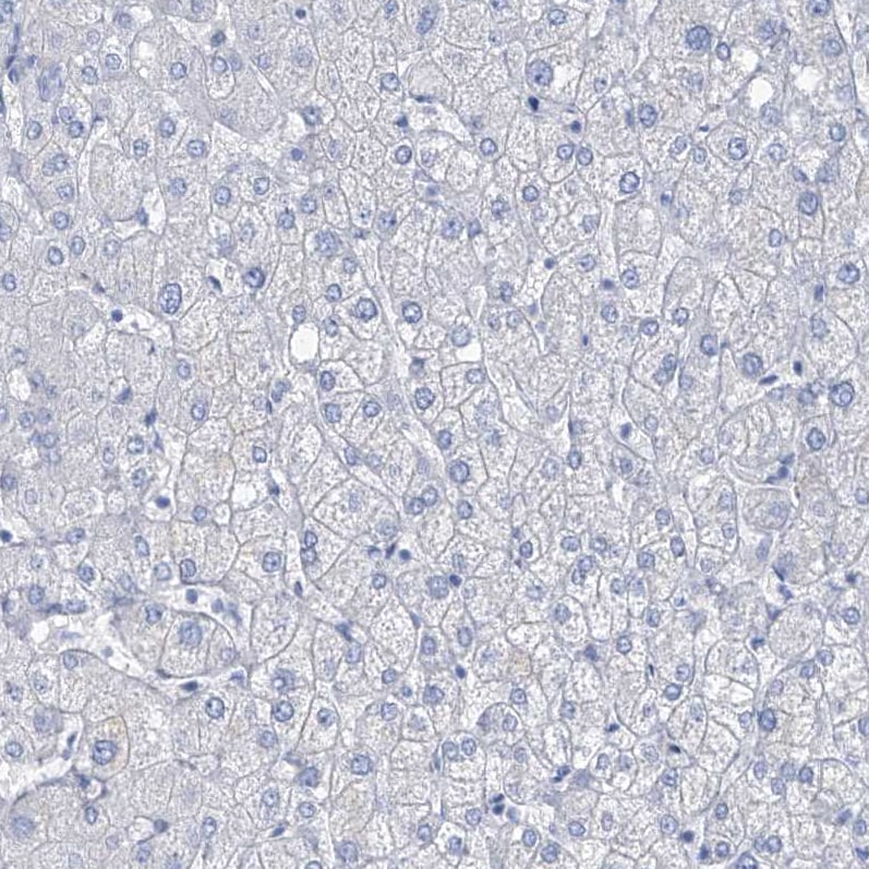 SGOL2 Antibody - BSA Free Immunohistochemistry-Paraffin: SGOL2 Antibody [NBP1-83567]