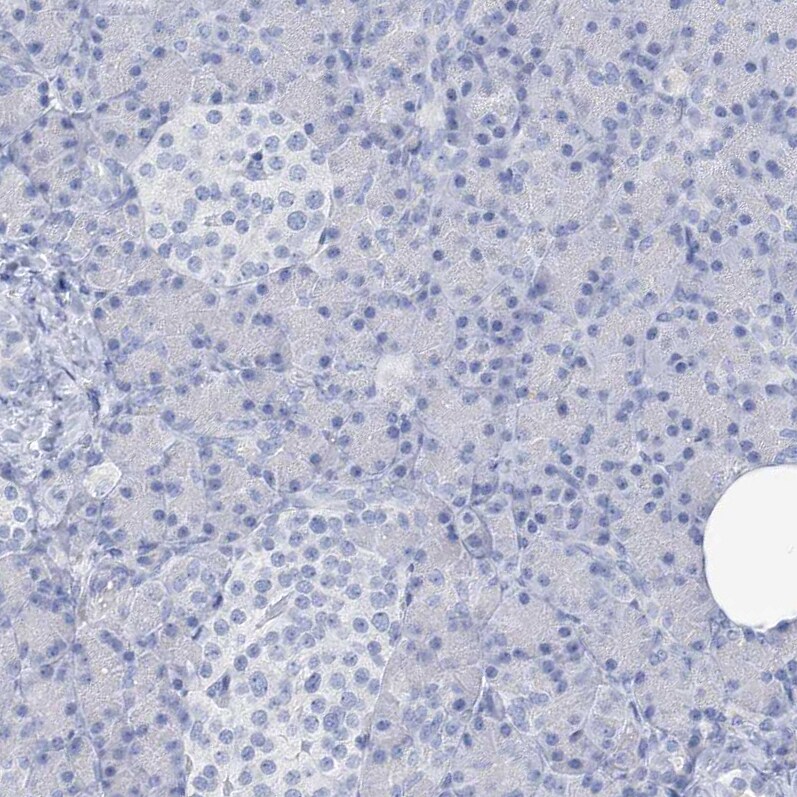 SGOL2 Antibody - BSA Free Immunohistochemistry-Paraffin: SGOL2 Antibody [NBP1-83567]