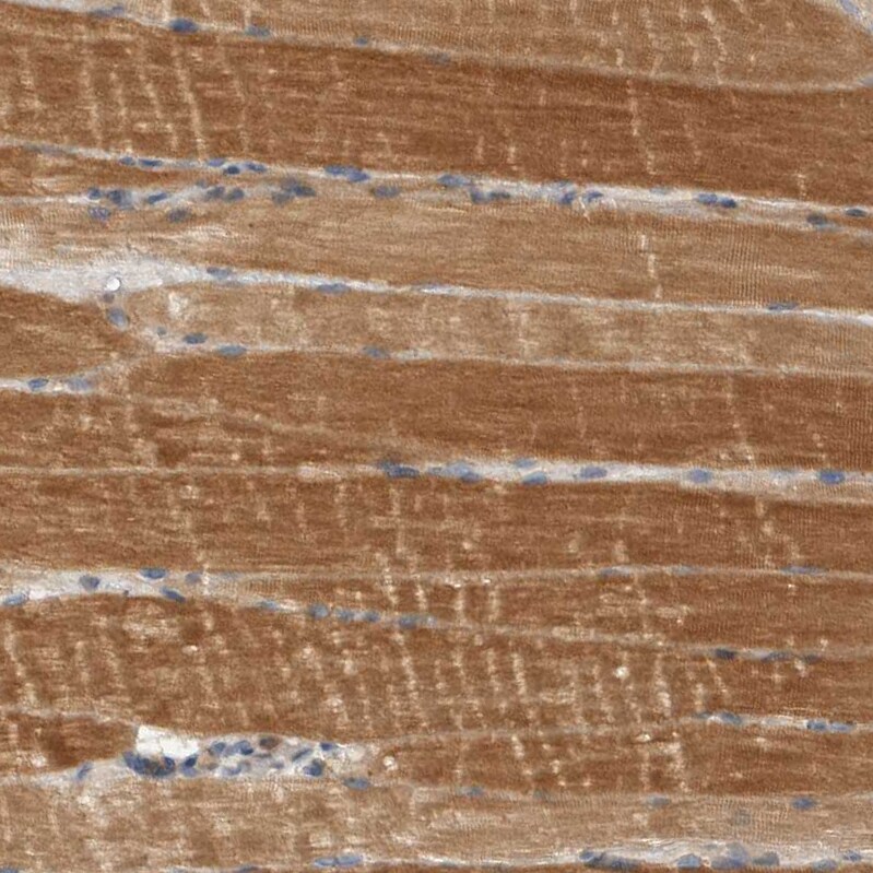 SCARA5 Antibody - BSA Free Immunohistochemistry-Paraffin: SCARA5 Antibody - BSA Free [NBP1-83572]