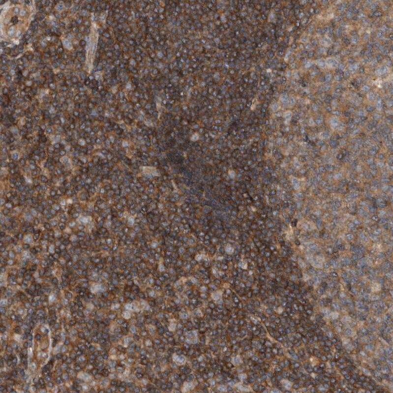 SCARA5 Antibody - BSA Free Immunohistochemistry-Paraffin: SCARA5 Antibody - BSA Free [NBP1-83572]