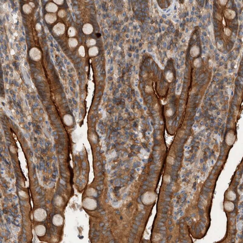SCARA5 Antibody - BSA Free Immunohistochemistry-Paraffin: SCARA5 Antibody - BSA Free [NBP1-83572]