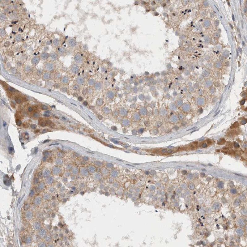 SCARA5 Antibody - BSA Free Immunohistochemistry-Paraffin: SCARA5 Antibody - BSA Free [NBP1-83572]